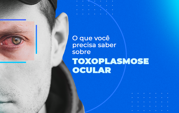 Toxoplasmose Ocular