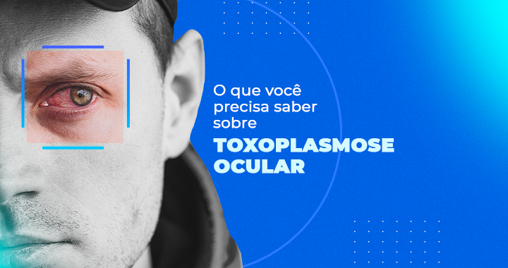 Toxoplasmose Ocular