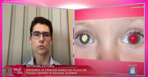 Dr. Gustavo Melo esclarece as principais dúvidas sobre o Retinoblastoma